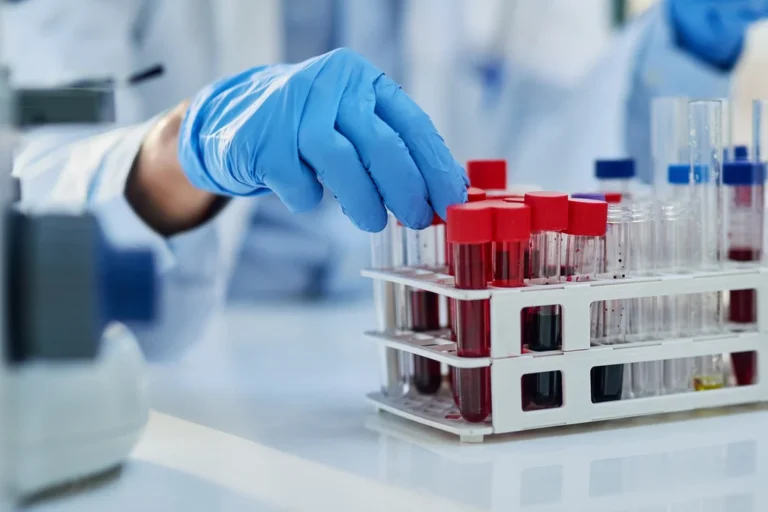 Test sanguin détecte cancers jusqu’à 3 ans avant symptômes