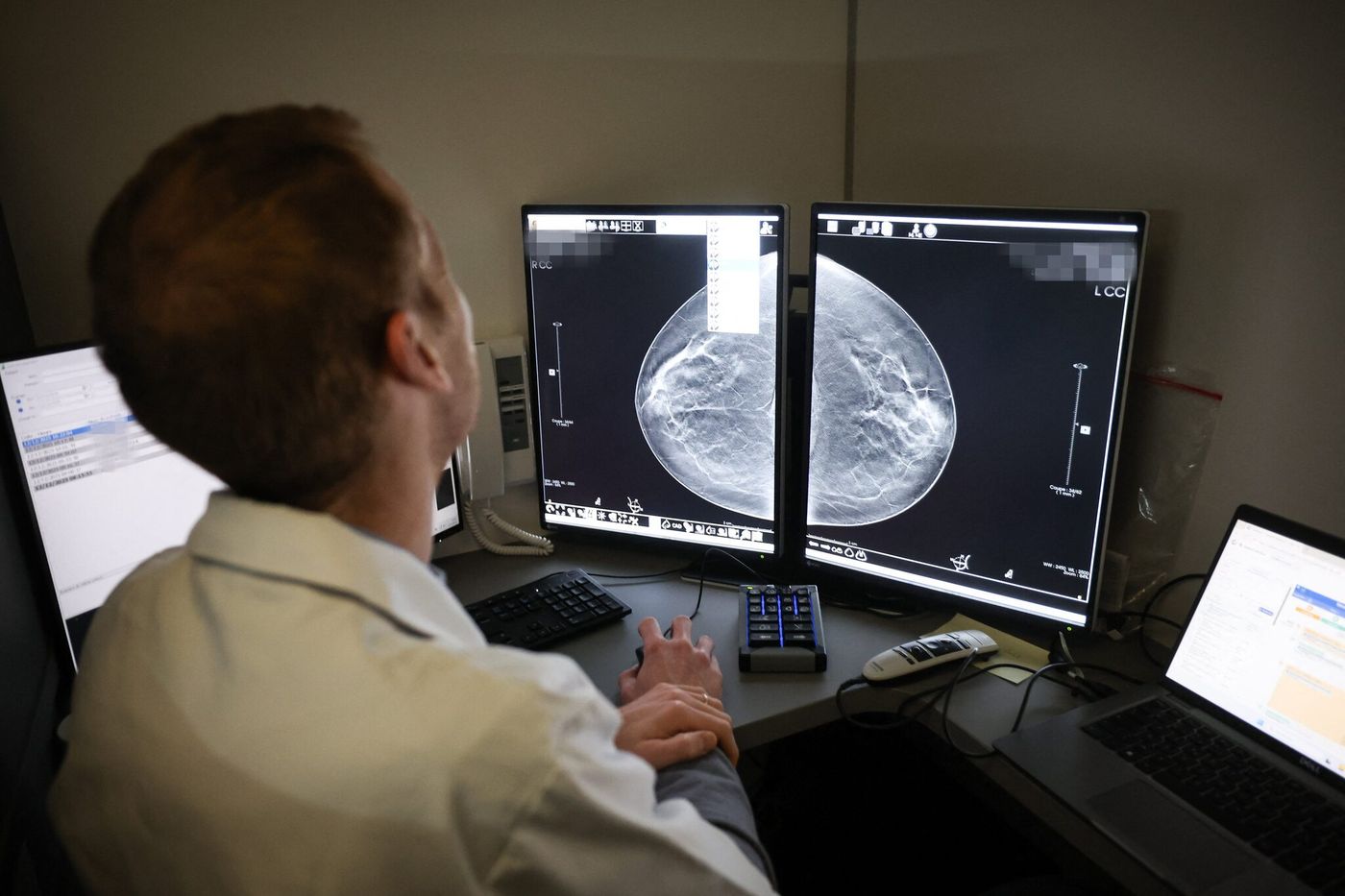 Capture du rapport sur la prise en charge du cancer du sein