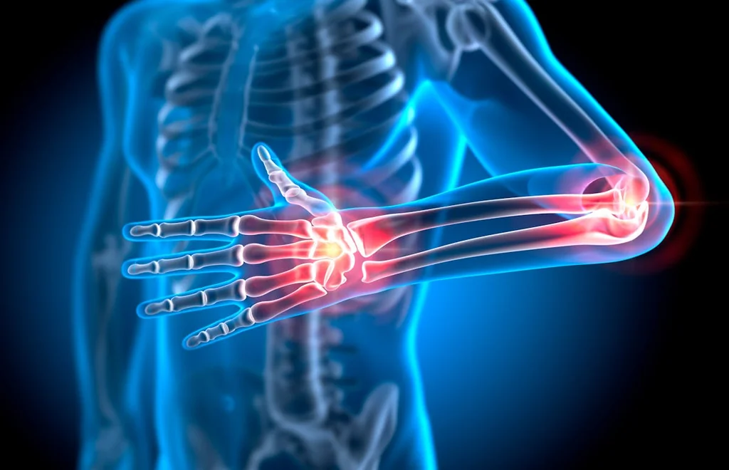 Le cubitus : un os clé pour la santé de votre bras