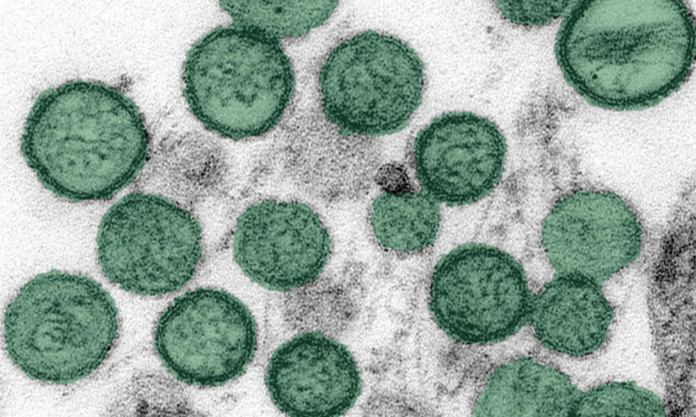 Hantavirus en France : où circule-t-il et comment l’éviter
