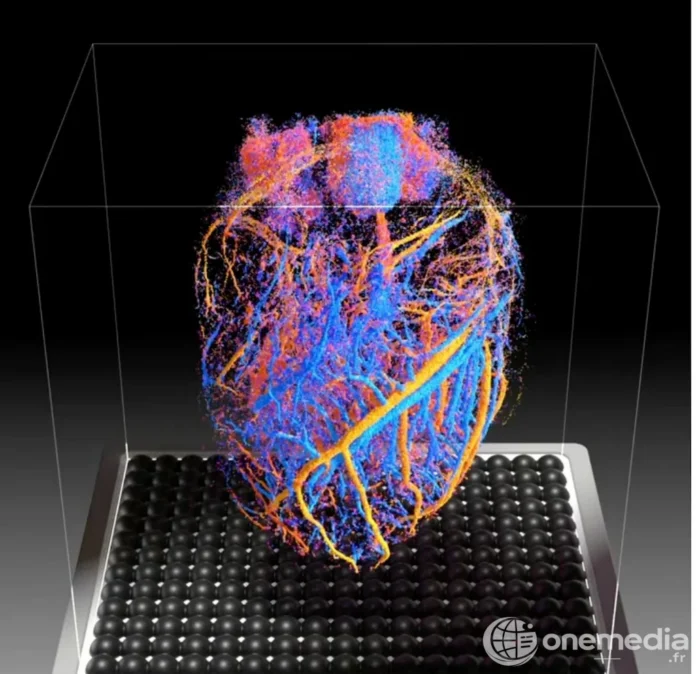 Une sonde à ultrasons pour visualiser les organes en 4D