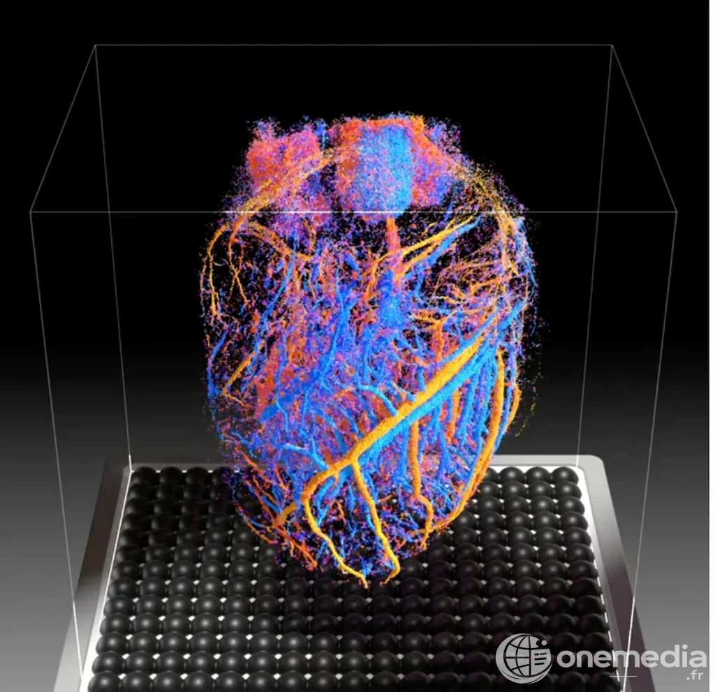 Une sonde à ultrasons pour visualiser les organes en 4D